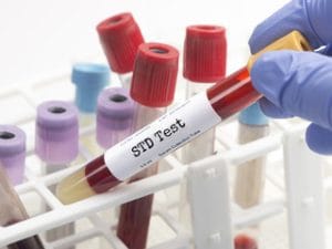 STD test