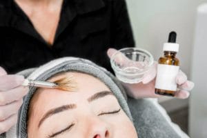 Chemical Peel Woman 300x200