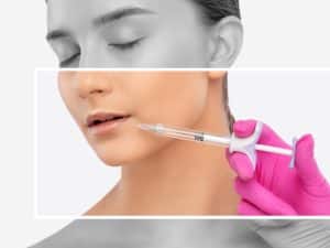 dermal filler female