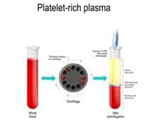 Empowering You Through Hair Restoration