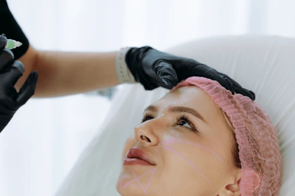Aesthetician skincare aftercare following Xela Rederm
