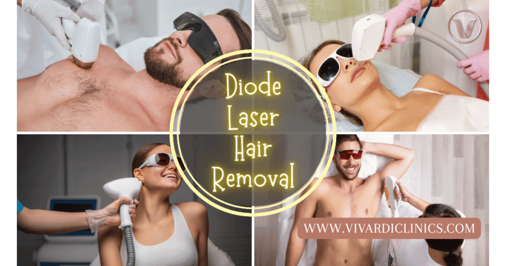 diode laser hair removal