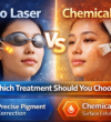 Pico Laser vs Chemical Peel Which Treatment Should You Choose Pico Laser vs Chemical Peel Which Treatment Should You Choose