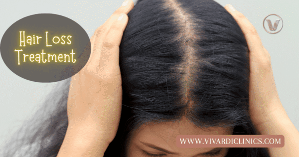 Start Hair Loss Treatment