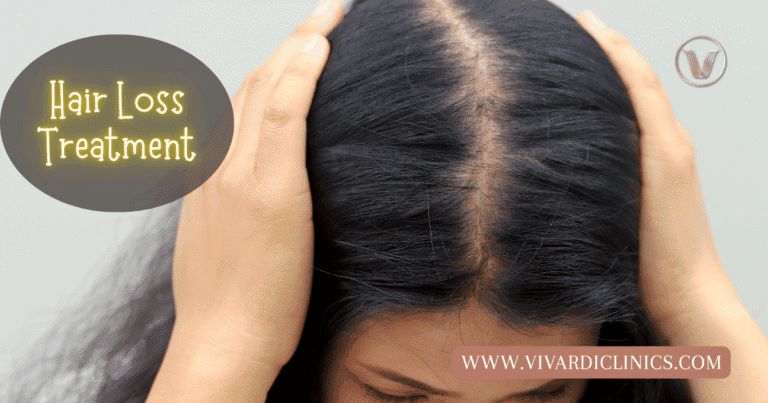 start hair loss treatment