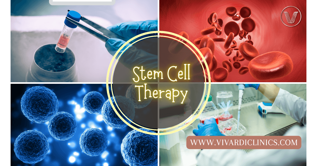 Stem Cell Therapy Improve Skin Health