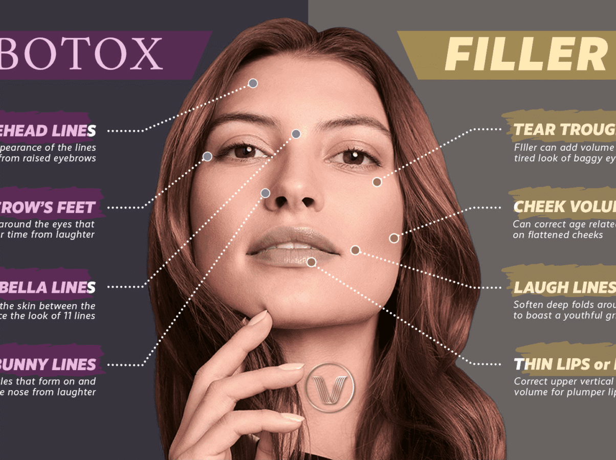 Botox Filler Selangor