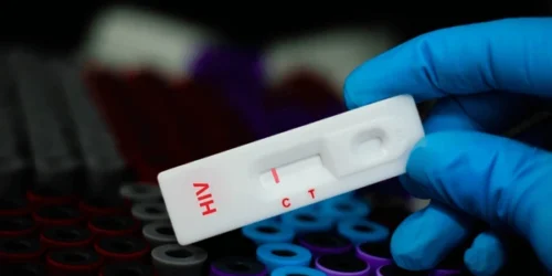 Blood sample patient negative tested hiv 600nw