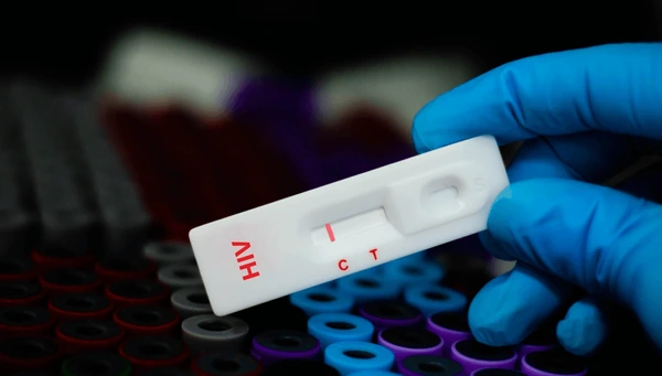 Blood sample patient negative tested hiv 600nw