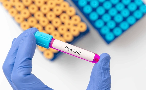Blood sample tube contain stem cells 600nw