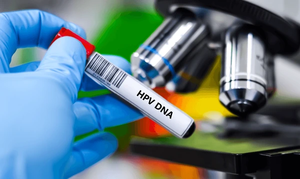 Blood sample tube for HPV DNA testing
