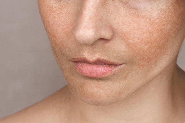 Close caucasian womans face freckles age 600nw