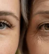 Close comparison eyes young woman older 600nw