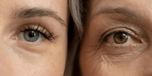 Close comparison eyes young woman older 600nw