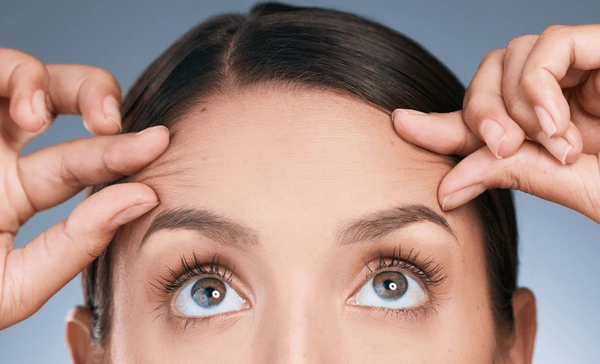 Collagen Biostimulator Fillers