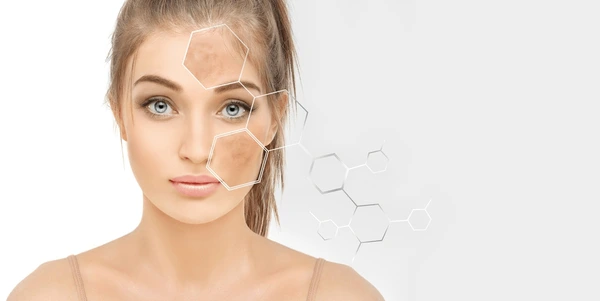 Pigmentation Therapy