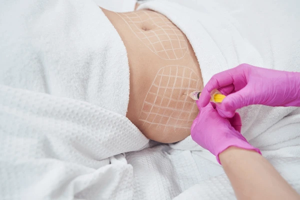 Dermatologist doing injection into subcutaneous fat 600nw