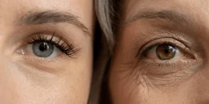 Close comparison eyes young woman older 600nw