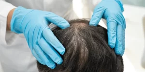 rawatan rambut gugur Selangor