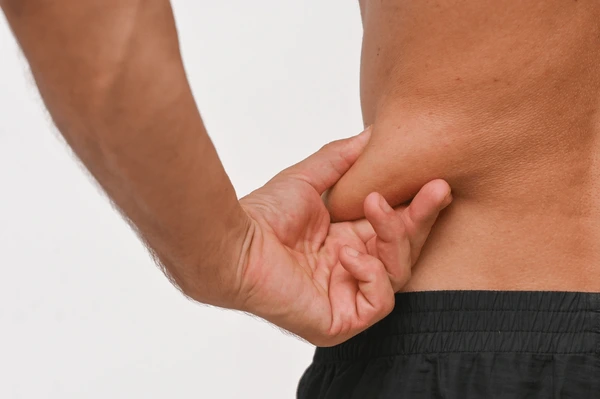 Fat deposits man on side 600nw