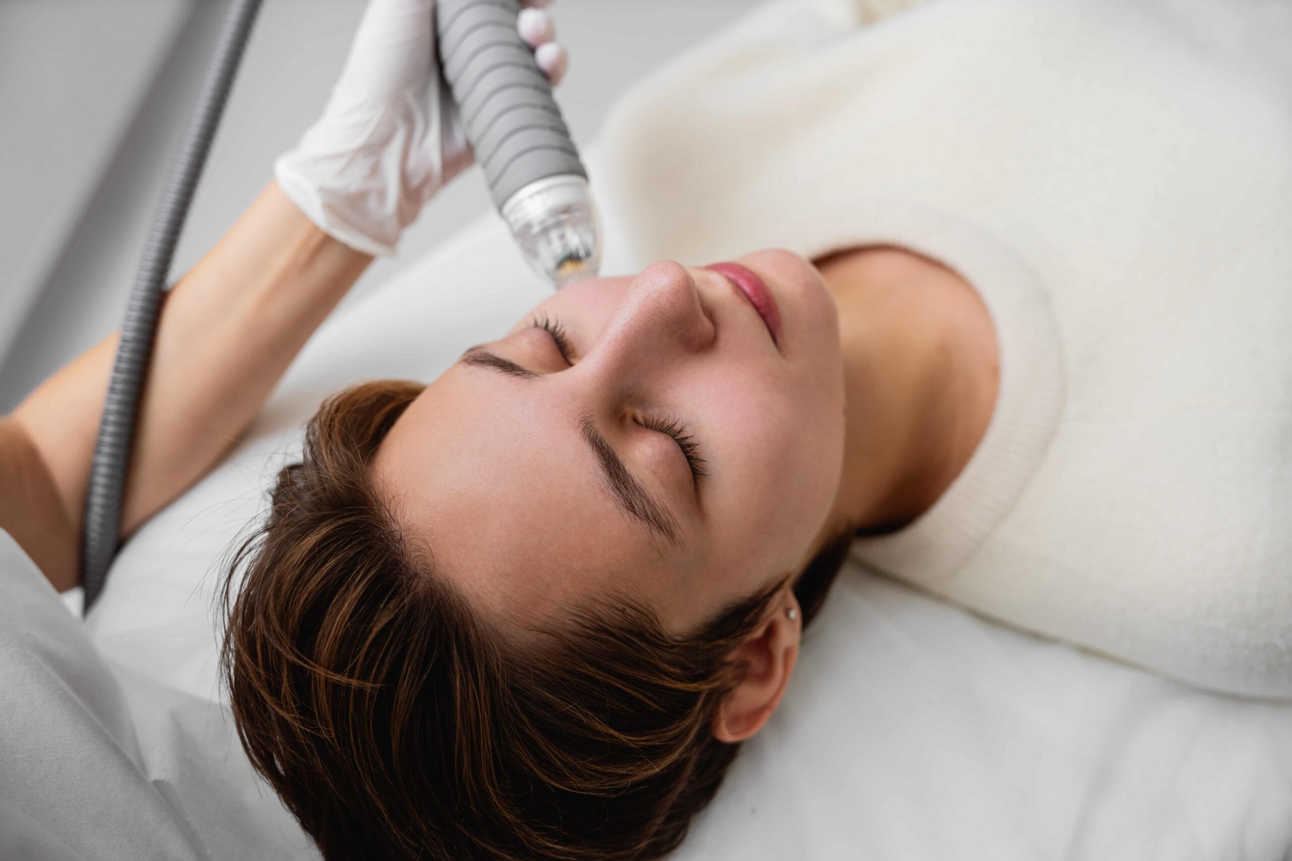 Pico laser skin treatment in progress