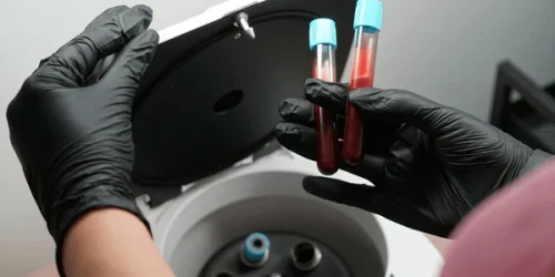 Platelet rich plasma prp treatment preparation 600nw