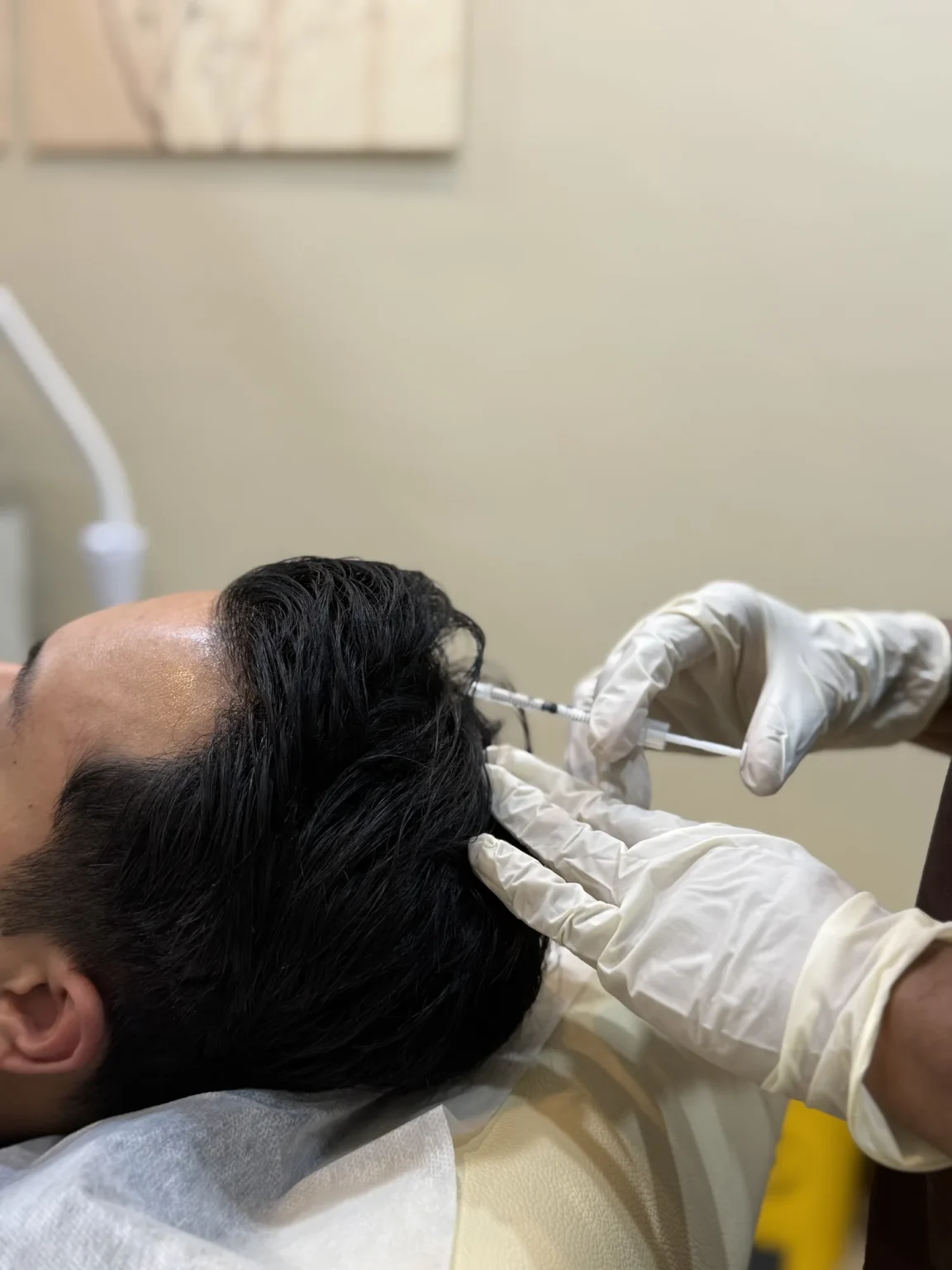 Doctor performing scalp injections for hair loss treatment at Vivardi Clinics Rawang
