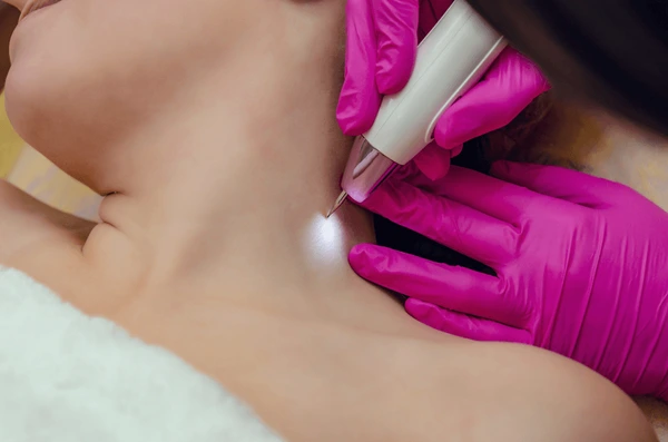 Removal Papillomas On Neck Beauty Salon 600Nw 1636510402
