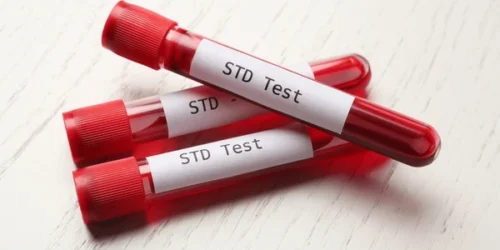 Tubes blood samples labels std test 600nw