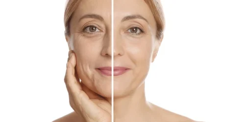 Woman showing face before after collagen 600nw
