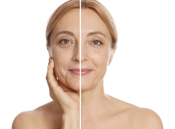 Woman showing face before after collagen 600nw